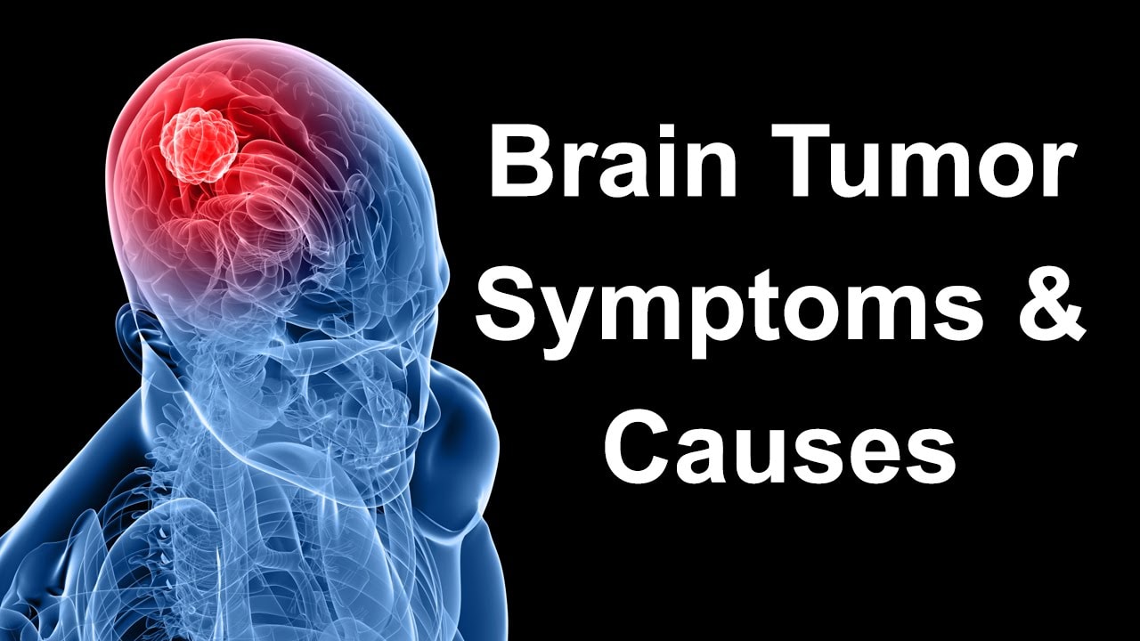 brain-cancer-causes