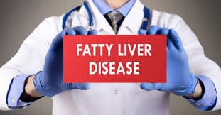 Fatty Liver Treatment