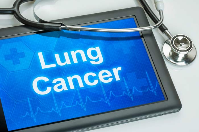 Lung Cancer On Ipad