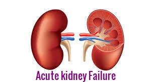 Kidney Fail