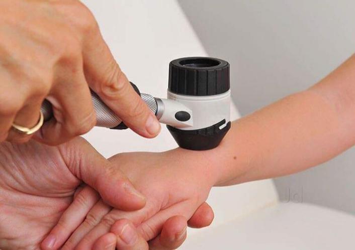 Homeopathy Treatment