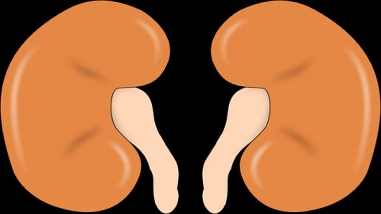 Kidney Failure