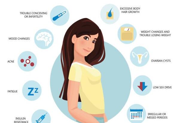 PCOS Causing Weight Gain
