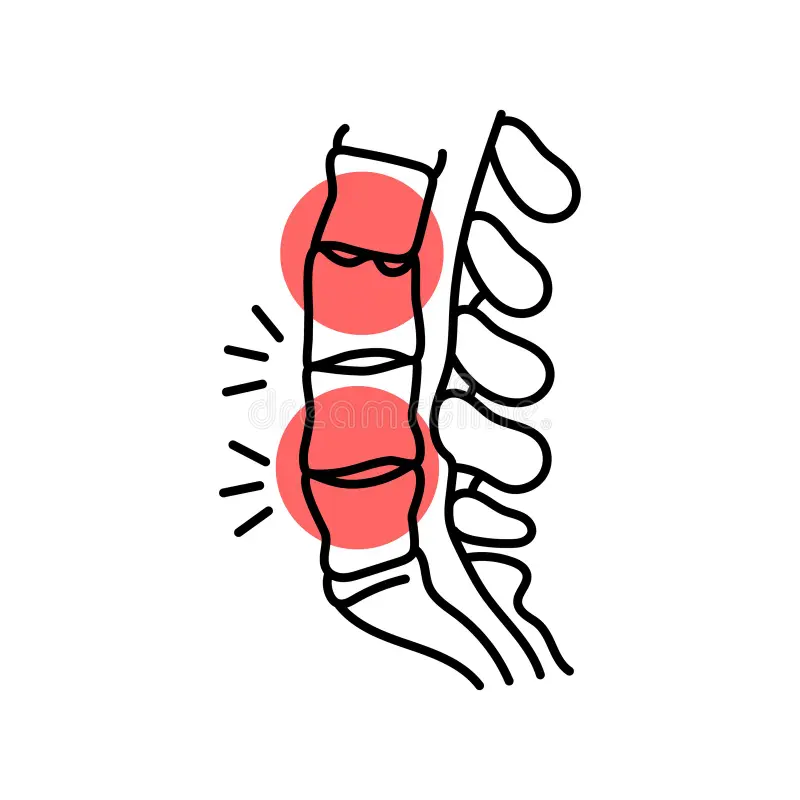 Musculoskeletal Disorder
