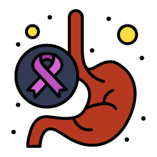 Stomach cancer