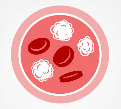 Leukemia Homeopathy treatment