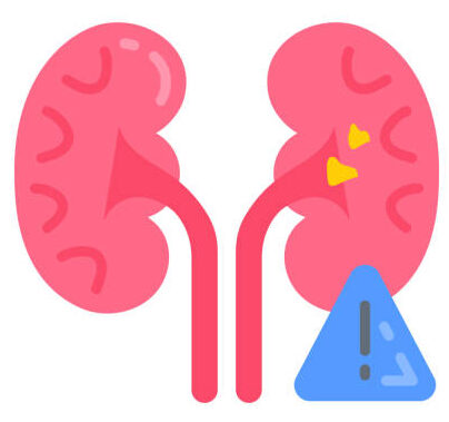 IGA Nephropathy