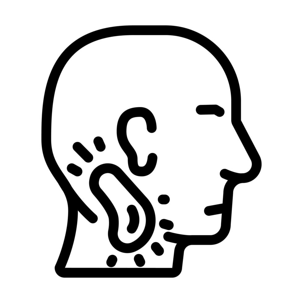 Hodgkin’s lymphoma Cancer