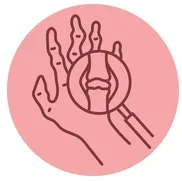 Rheumatoid Arthritis