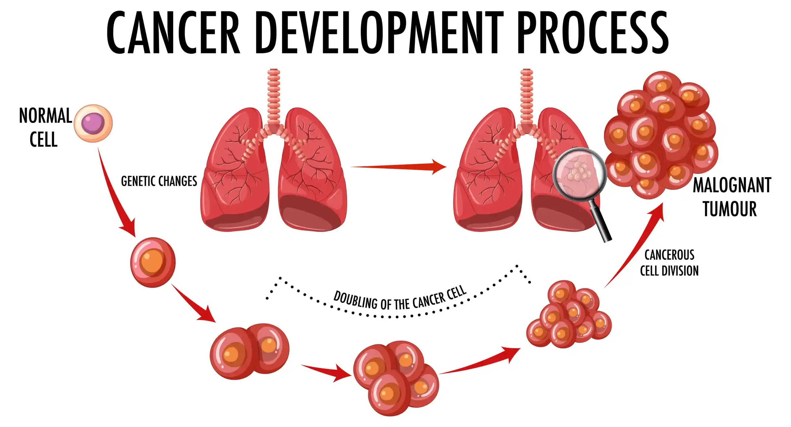 Lung Cancer Development Process