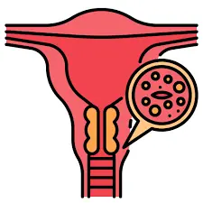 Cervical Cancer Treatment